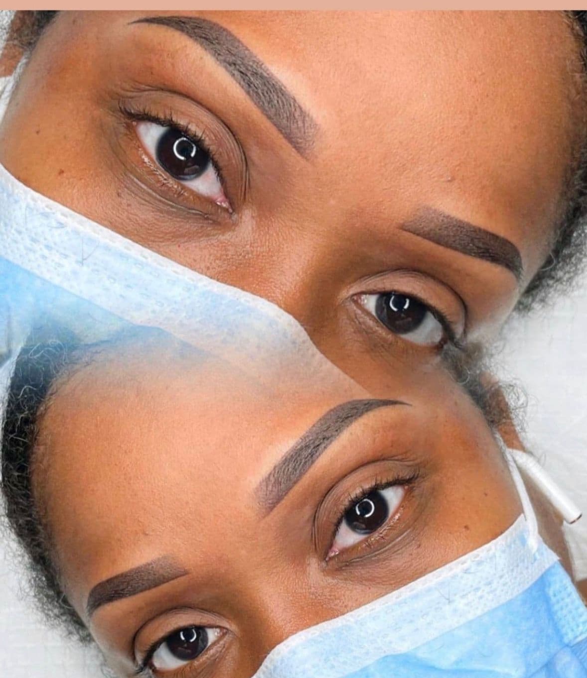 Brows Enhancement - Image 1